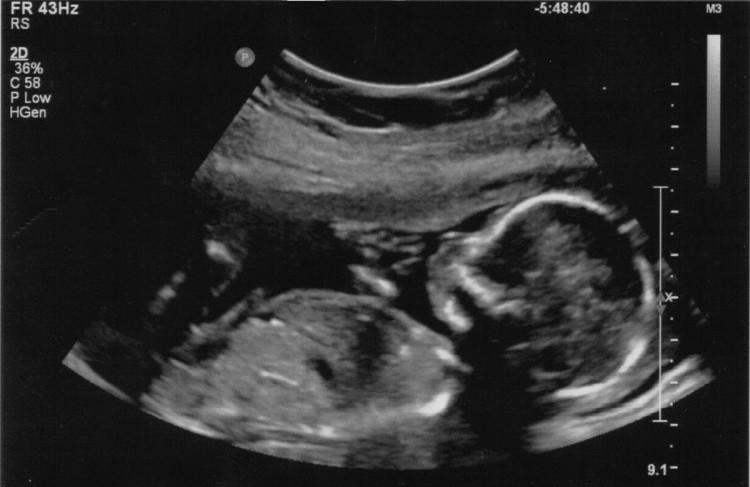 27 неделя беременности интересные факты