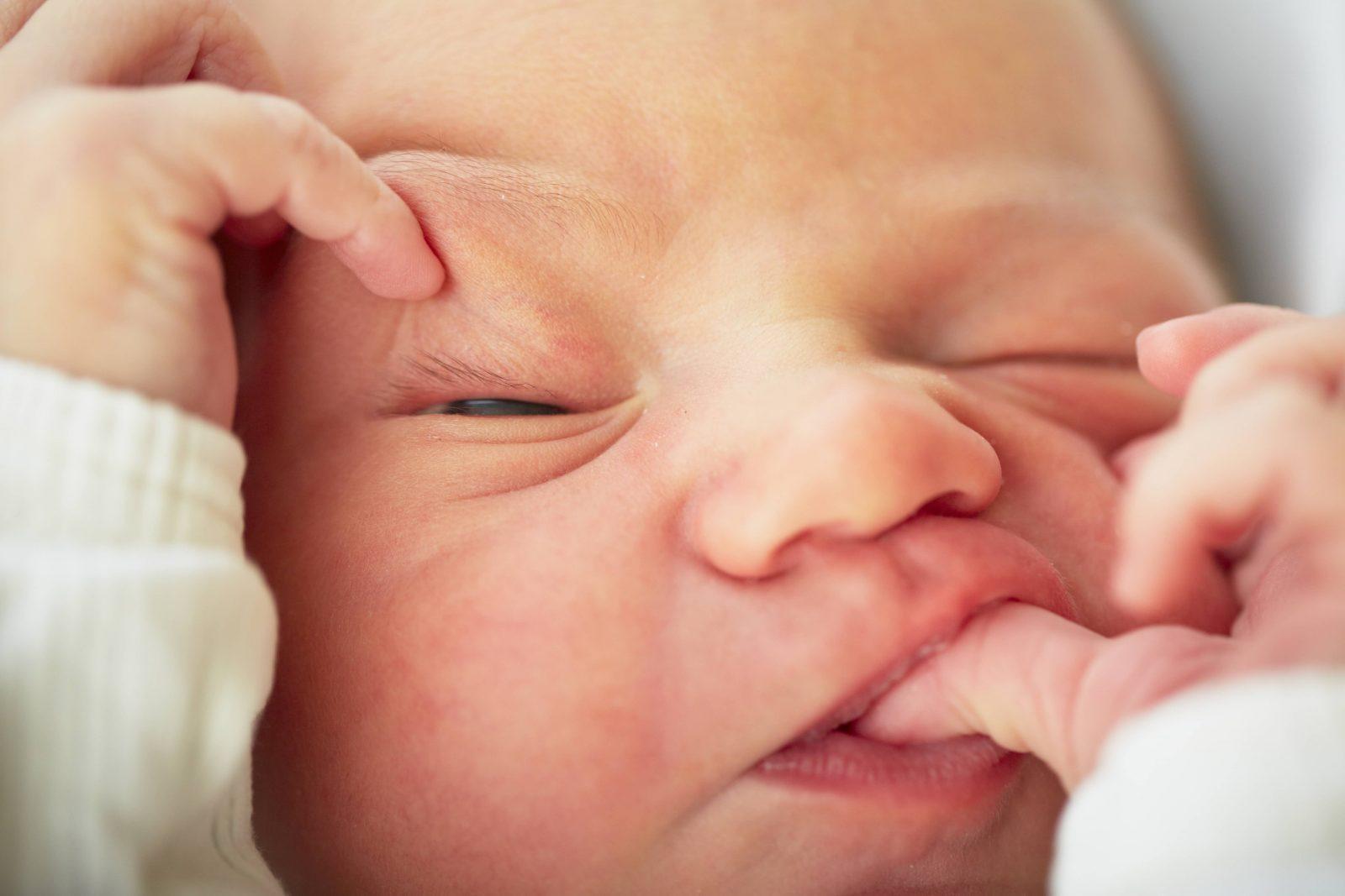 Кожа на лице новорожденного thumbnail